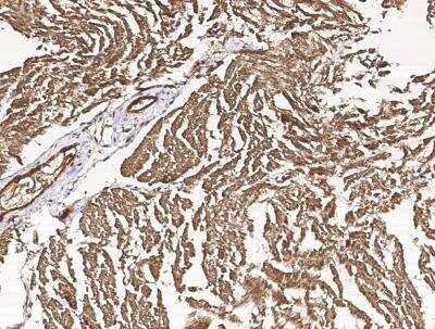 Immunohistochemistry-Paraffin: CIB2 Antibody (001) [NBP2-90129]