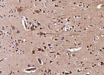 Immunohistochemistry-Paraffin: CIB2 Antibody (001) [NBP2-90129]