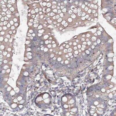 Immunohistochemistry-Paraffin: CIB2 Antibody [NBP1-81351]