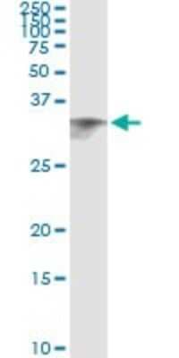 Immunoprecipitation: CIDEA Antibody (4B9) [H00001149-M01]