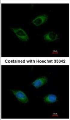 Immunocytochemistry/ Immunofluorescence: CIDEC Antibody [NBP2-15902]