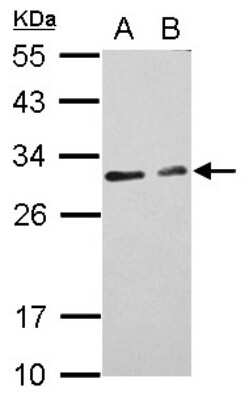 Western Blot: CIDEC Antibody [NBP2-15903]