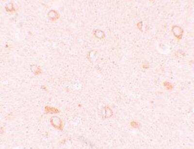 Immunohistochemistry-Paraffin: CIITA Antibody - BSA Free [NBP2-59072]
