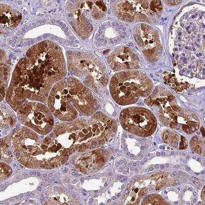 Immunohistochemistry-Paraffin: CILP2 Antibody [NBP1-93469]