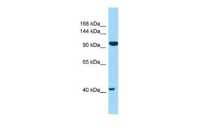 Western Blot: CILP2 Antibody [NBP2-82688]