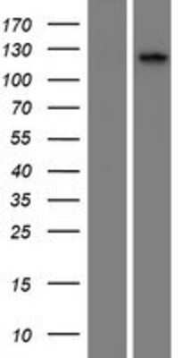 Western Blot: CILP2 Overexpression Lysate [NBP2-05275]