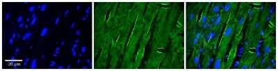 Immunohistochemistry: CIN85/SH3KBP1 Antibody [NBP1-57065]