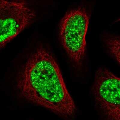 Immunocytochemistry/ Immunofluorescence: CIP29 Antibody [NBP1-88084]