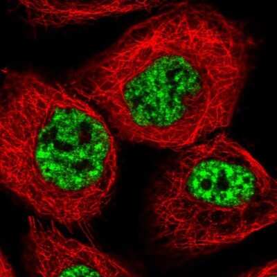Immunocytochemistry/ Immunofluorescence: CIP29 Antibody [NBP1-91788]