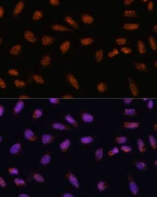 Immunocytochemistry/ Immunofluorescence: CIP29 Antibody - Azide and BSA Free [NBP2-92120]