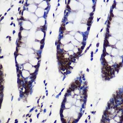 Immunohistochemistry-Paraffin: CIP29 Antibody - Azide and BSA Free [NBP2-92120]