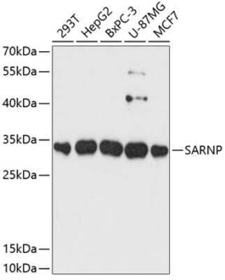 Western Blot: CIP29 AntibodyAzide and BSA Free [NBP2-92120]
