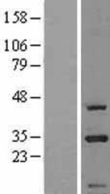 Western Blot: CIP29 Overexpression Lysate [NBL1-09210]