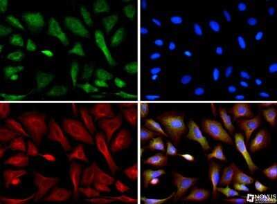 Immunocytochemistry/ Immunofluorescence: CIP2A Antibody (2G10) - Azide and BSA Free [NBP2-80670]