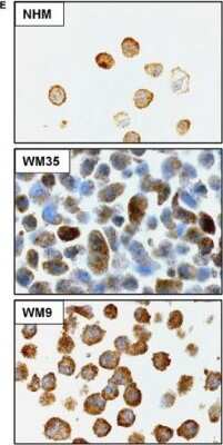 Immunohistochemistry: CIP2A Antibody [NB100-74663]