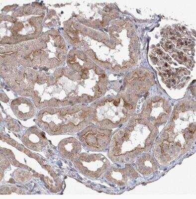 Immunohistochemistry-Paraffin: CIPAR-1 Antibody [NBP1-85610]