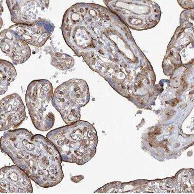 Immunohistochemistry-Paraffin: CIPAR-1 Antibody [NBP1-85610]