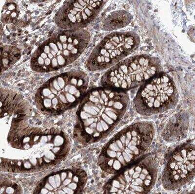 Immunohistochemistry-Paraffin: CIPAR-1 Antibody [NBP1-85610]