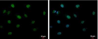 Immunocytochemistry/ Immunofluorescence: CIRBP Antibody [NBP2-15905]
