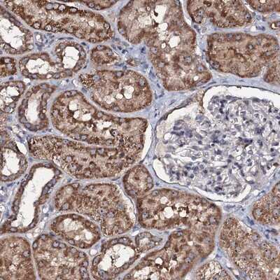 Immunohistochemistry-Paraffin: CIRH1A Antibody [NBP1-91789]