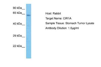 Western Blot: CIRH1A Antibody [NBP2-84687]
