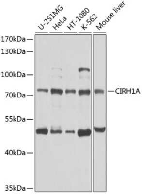 Western Blot: CIRH1A AntibodyBSA Free [NBP2-92565]