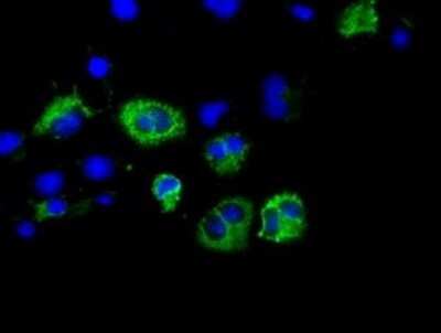 Immunocytochemistry/ Immunofluorescence: CISD1 Antibody (OTI2B3) - Azide and BSA Free [NBP2-72024]