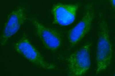 Immunocytochemistry/ Immunofluorescence: CISD1 Antibody (OTI2B3) - Azide and BSA Free [NBP2-72024]
