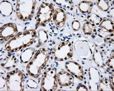 Immunohistochemistry: CISD1 Antibody (OTI4G3) - Azide and BSA Free [NBP2-72026]