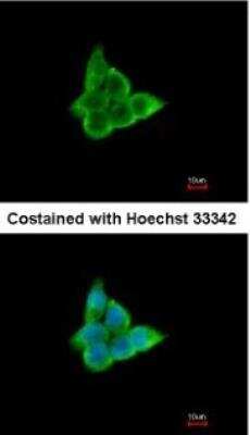 Immunocytochemistry/ Immunofluorescence: CISH/CIS-1 Antibody [NBP1-30943]