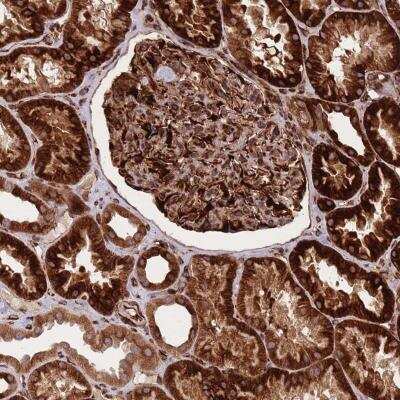Immunohistochemistry-Paraffin: CISH/CIS-1 Antibody [NBP2-38474]