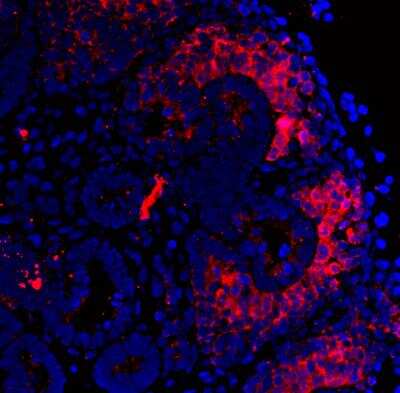 Immunohistochemistry-Paraffin: CITED1 Antibody (5H6) [H00004435-M03]