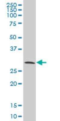 Western Blot: CITED1 Antibody (6C1) [H00004435-M02]