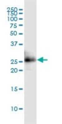 Western Blot: CITED1 Antibody (6C1) [H00004435-M02]