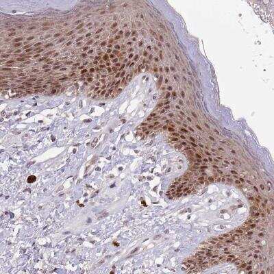 Immunohistochemistry-Paraffin: CIZ1 Antibody [NBP2-33890]