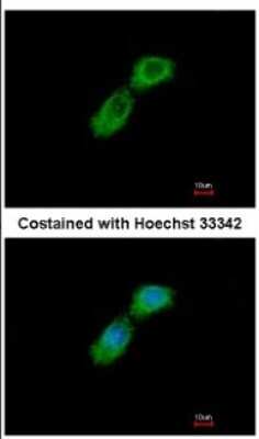 Immunocytochemistry/ Immunofluorescence: CKAP1 Antibody [NBP1-33462]