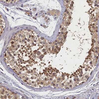 Immunohistochemistry-Paraffin: CKAP1 Antibody [NBP1-85671]