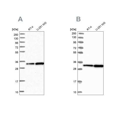 Western Blot: CKAP1 Antibody [NBP1-85671]