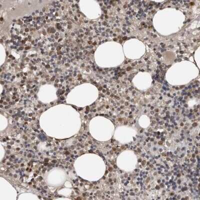 Immunohistochemistry-Paraffin: CKAP2 Antibody [NBP1-84603]