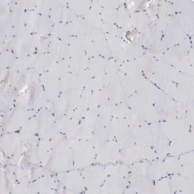 Immunohistochemistry-Paraffin: CKAP2 Antibody [NBP1-84603]