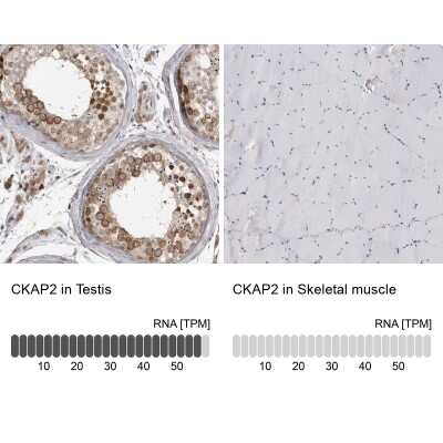 Immunohistochemistry-Paraffin: CKAP2 Antibody [NBP1-84603]