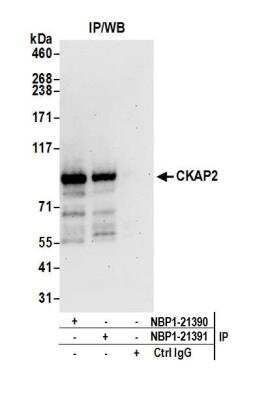 Immunoprecipitation: CKAP2 Antibody [NBP1-21391]