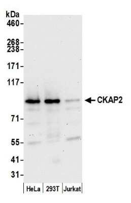 Western Blot: CKAP2 Antibody [NBP1-21391]