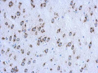 Immunohistochemistry-Paraffin: CKAP4/p63 Antibody [NBP2-15908]