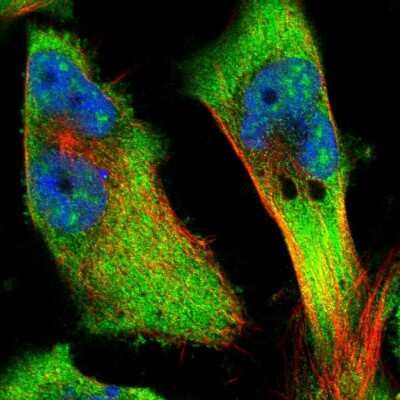 Immunocytochemistry/ Immunofluorescence: CKAP4/p63 Antibody [NBP2-55266]
