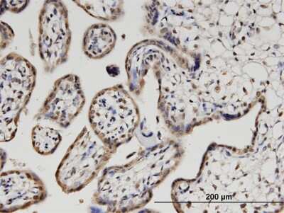 Immunohistochemistry-Paraffin: CKIP-1 Antibody (1C7) [H00051177-M03]
