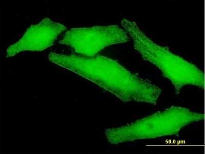 Immunocytochemistry/ Immunofluorescence: CKIP-1 Antibody [H00051177-B01P]