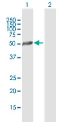 Western Blot: CKIP-1 Antibody [H00051177-B01P]