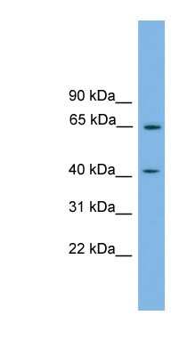 Western Blot: CKIP-1 Antibody [NBP1-56986]