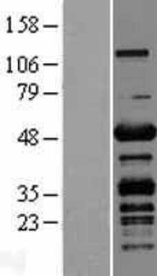 Western Blot: CKIP-1 Overexpression Lysate [NBL1-14512]